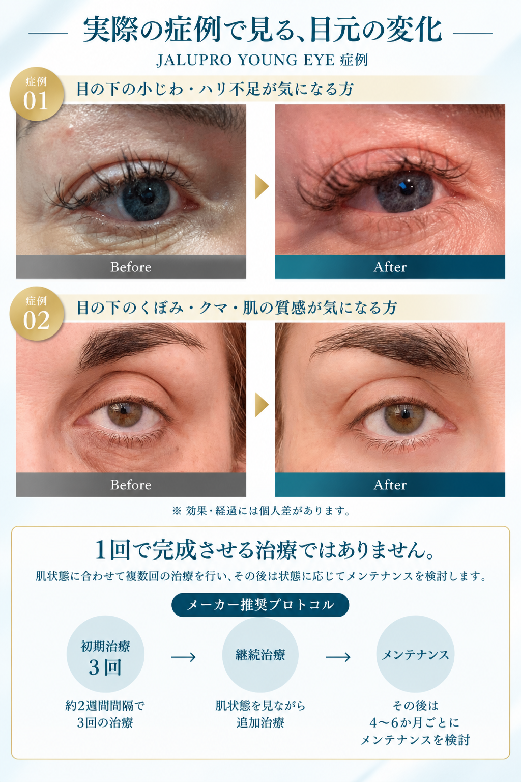 ジャルプロヤングアイ 症例写真