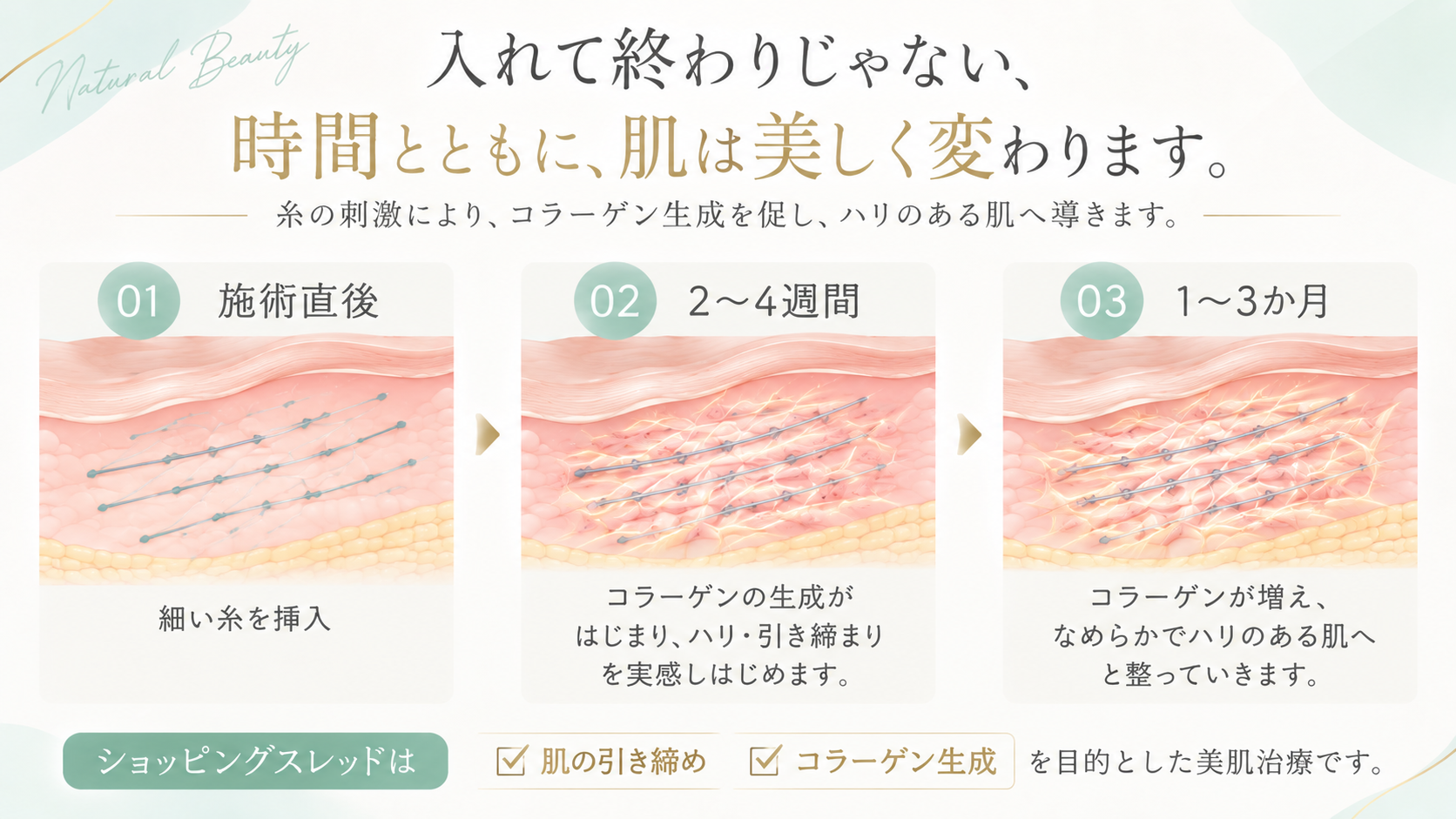 ショッピングスレッドの効果を感じる時期。施術直後から2〜4週間、1〜3か月にかけて変化を評価