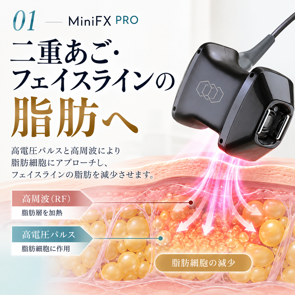 インモードVリフトPROのMiniFX PROによる顎下脂肪・二重あご・フェイスラインへの脂肪減少アプローチ