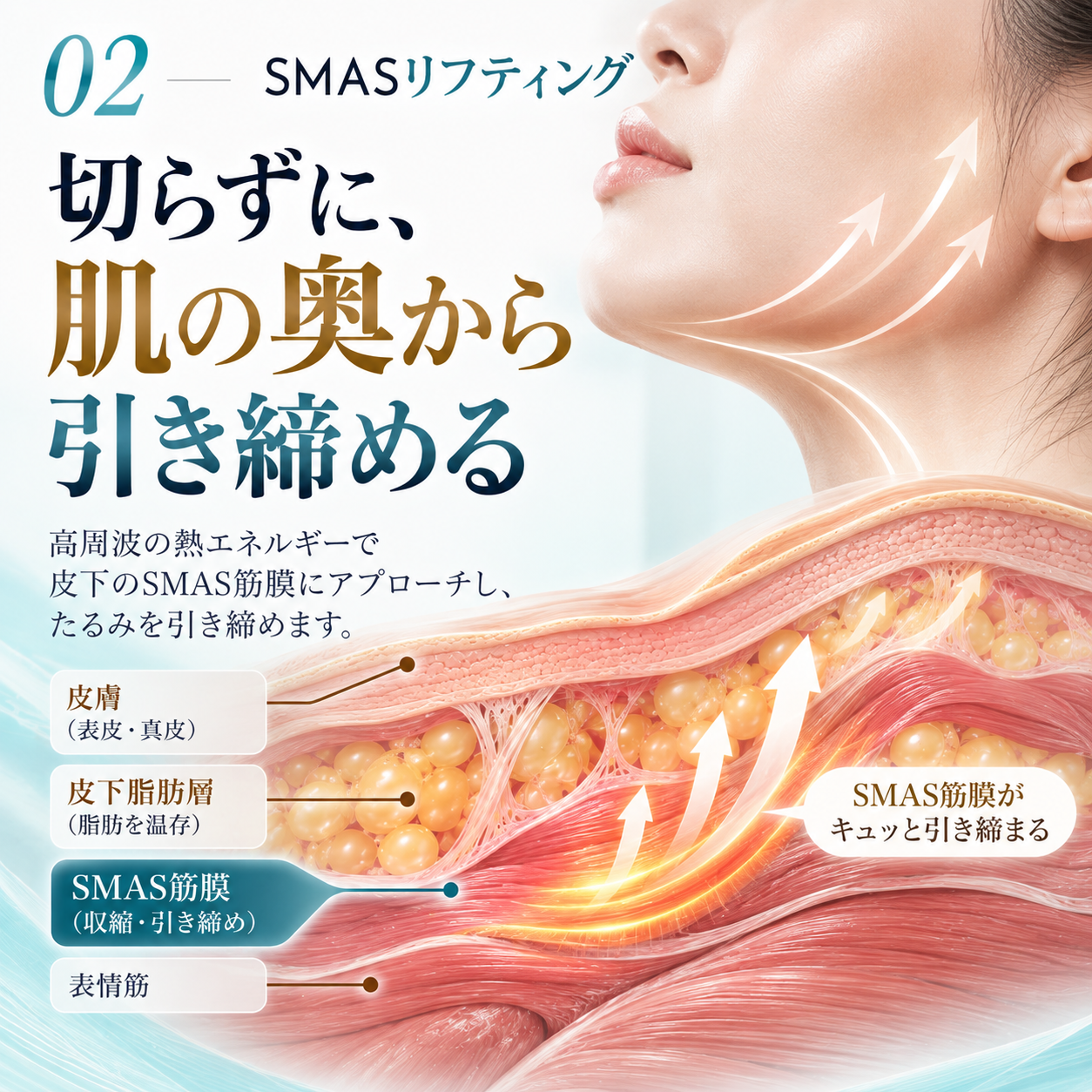 MiniFX PROのSMASリフティングモードによる脂肪を温存した頬の引き締め治療のイメージ